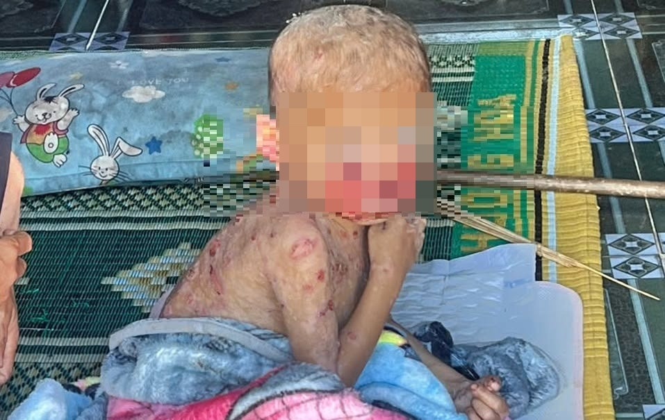 Mang 'bệnh lạ' từ lúc lọt lòng, bé trai vùng cao vẫn chưa có tiền đi chữa