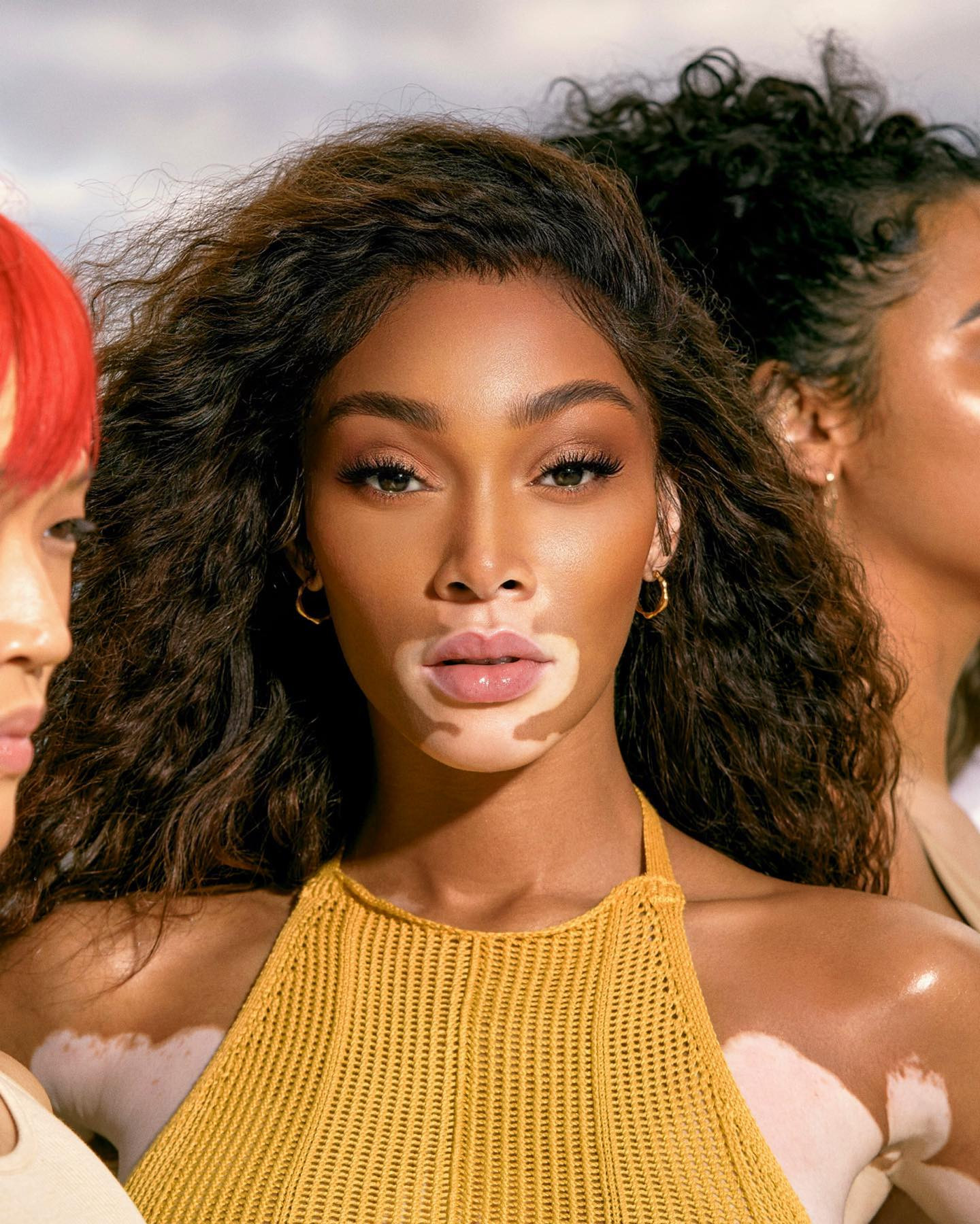 Photo shared by Winnie Harlow on February 28, 2022 tagging @cayskin.jpeg