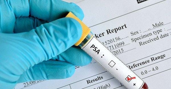 Nam giới từ 40 tuổi cần làm một xét nghiệm để sàng lọc ung thư tuyến tiền liệt