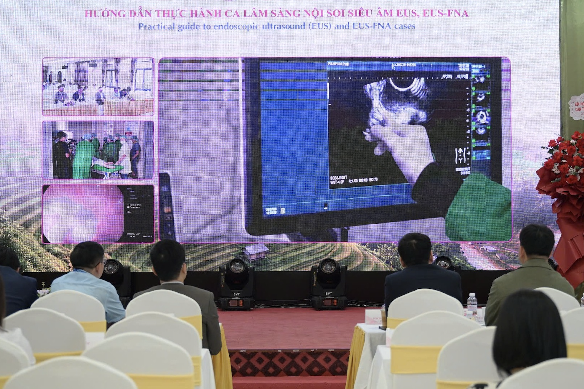 Ung thư đại trực tràng tăng nhanh, có bệnh nhân mới 14 tuổi đã mắc