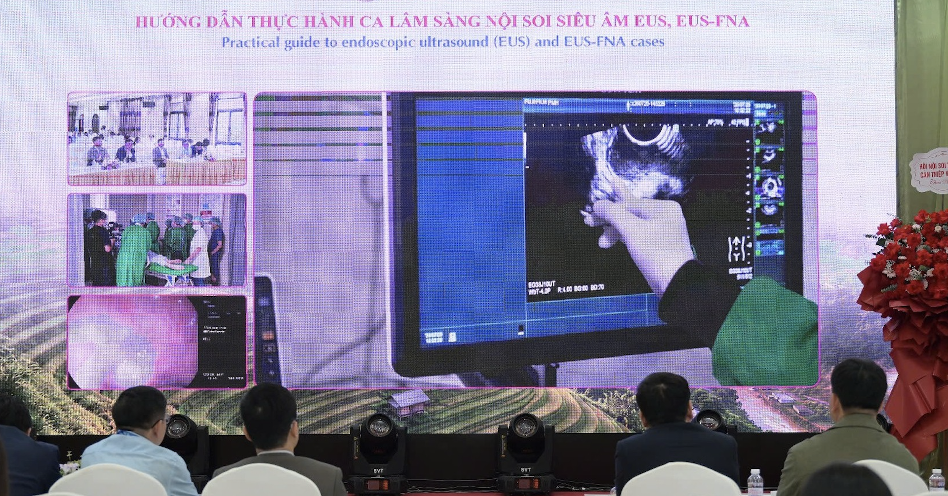 Ung thư đại trực tràng tăng nhanh, có bệnh nhân mới 14 tuổi đã mắc