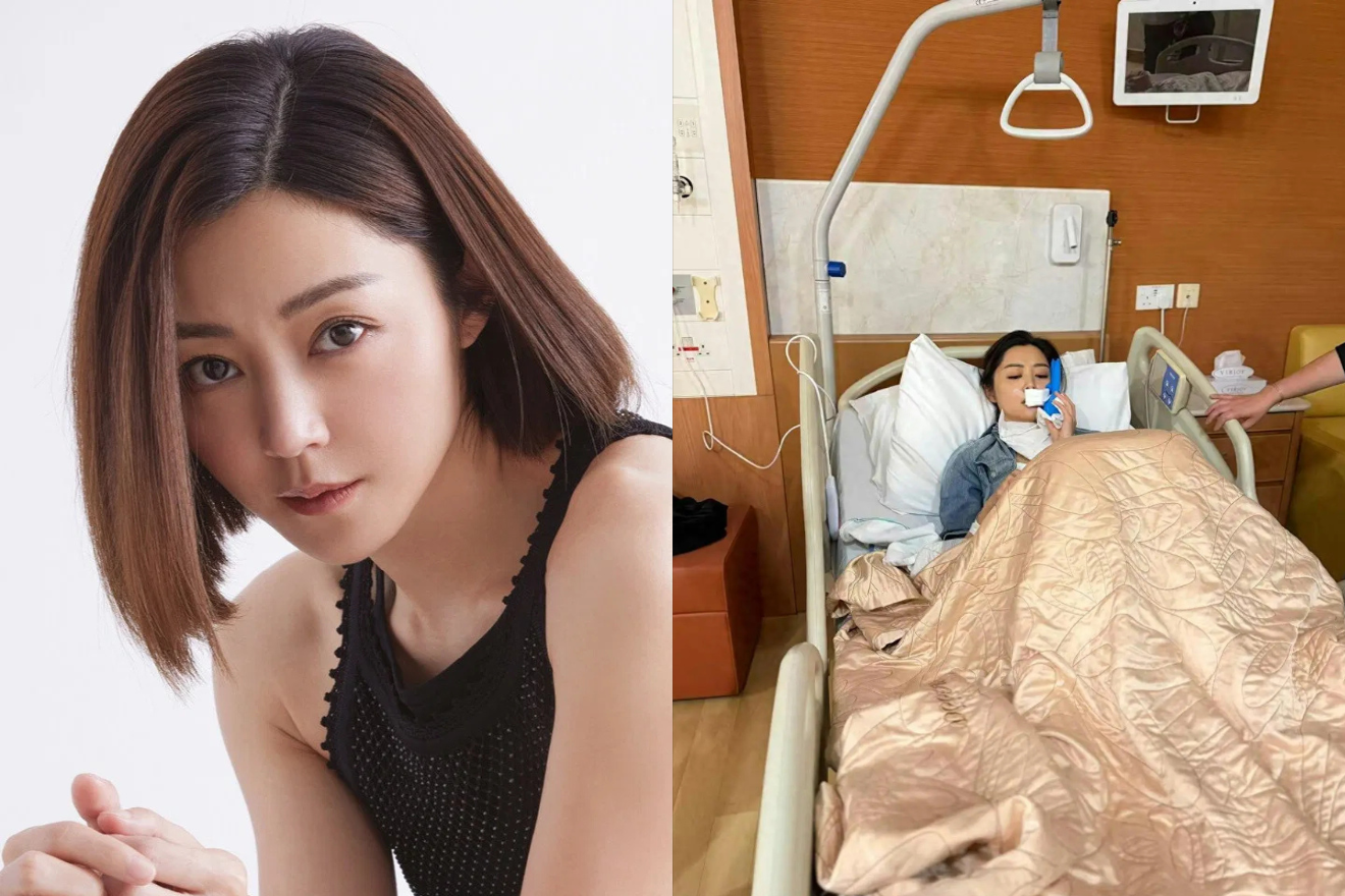 Nữ diễn viên 42 tuổi khâu hơn 50 mũi sau tai nạn trên phim trường