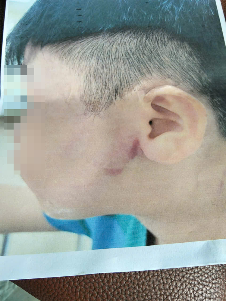 bao hanh tre em.png