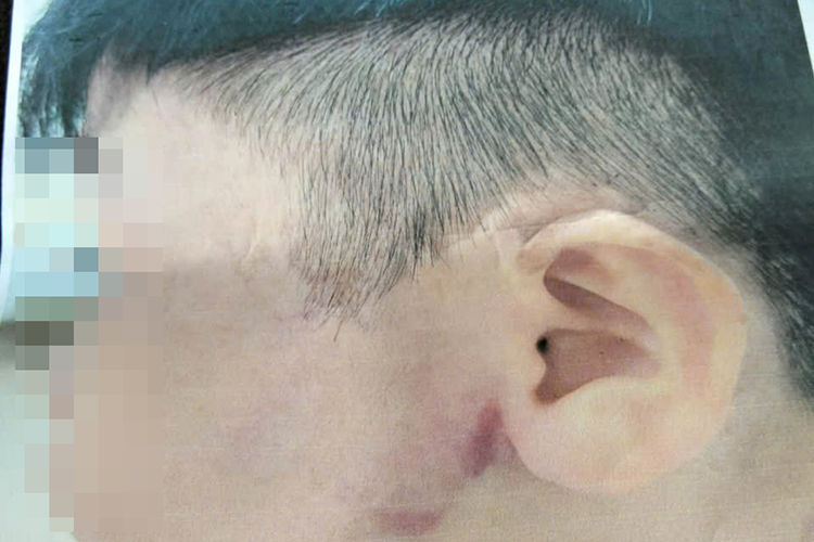 Điều tra vụ bé trai 9 tuổi nghi bị cha ruột bạo hành ở TPHCM