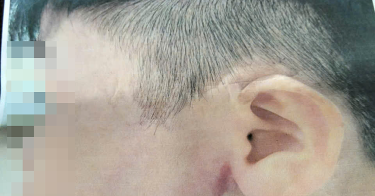 Điều tra vụ bé trai 9 tuổi nghi bị cha ruột bạo hành ở TPHCM