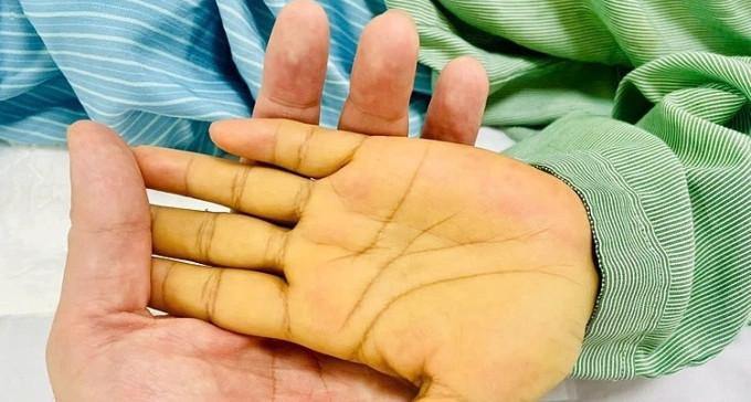 Tuổi 23 bàng hoàng với căn bệnh ác tính "không còn làm gì được nữa"