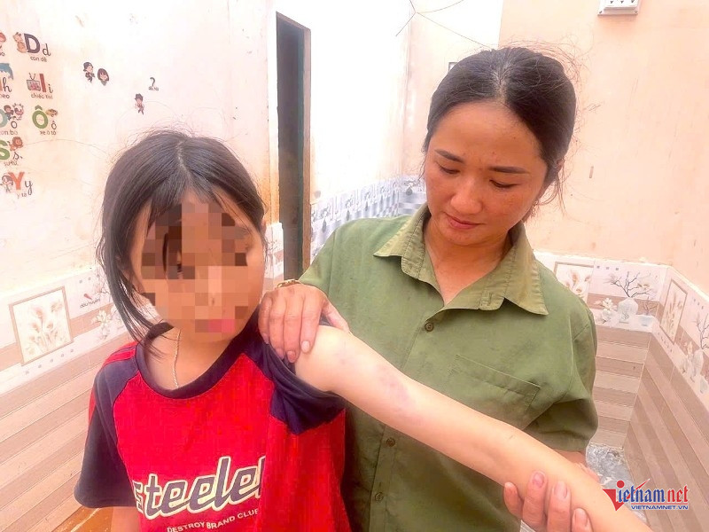 W-Lốc xoáy 3.jpg