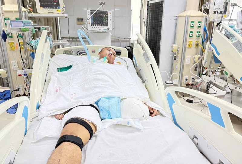 Chàng trai 22 tuổi gặp tai nạn nguy kịch, gia đình chật vật lo chi phí điều trị