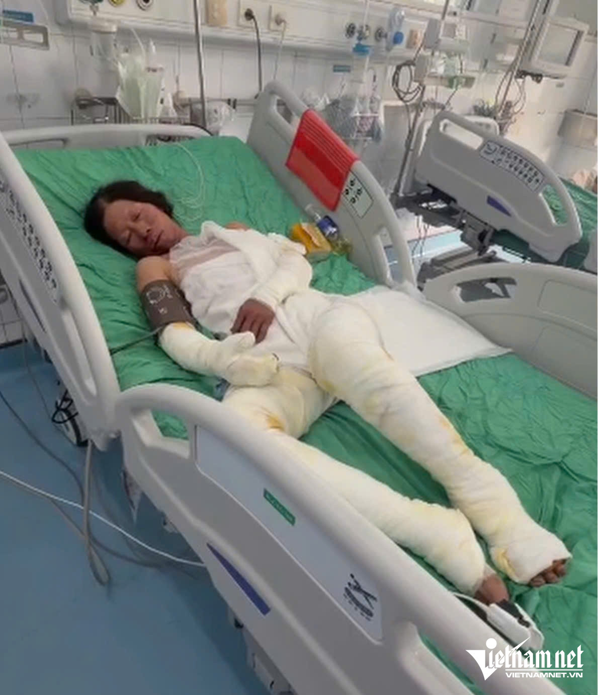 W-a bà bỏng4.jpg