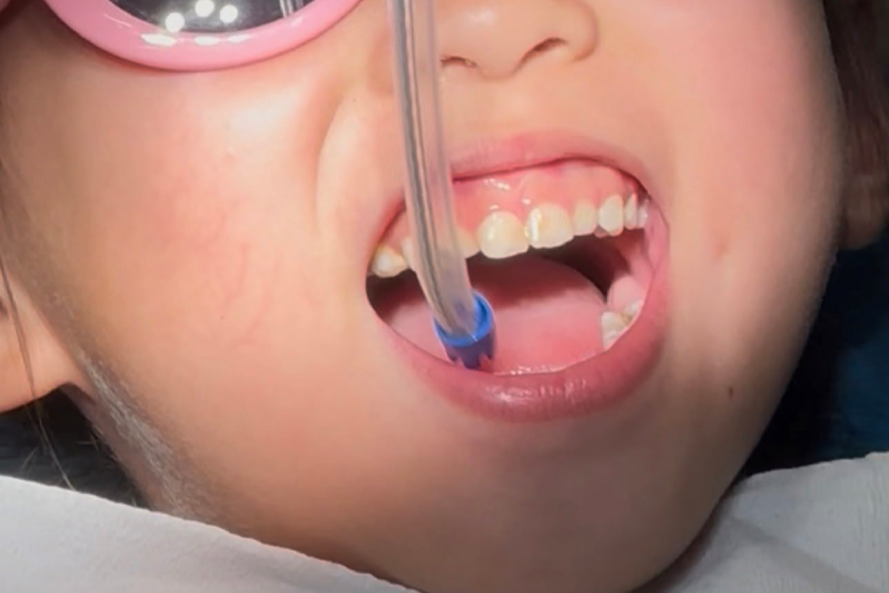 Lý do tiến sĩ dược làm việc ở Mỹ đưa con về Việt Nam chữa răng sâu