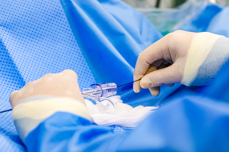 Hai vợ chồng cùng cấp cứu vì nhồi máu cơ tim