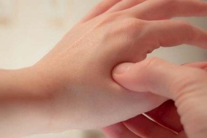 Nắng mưa thất thường, thử day 5 huyệt giúp giảm đau đầu