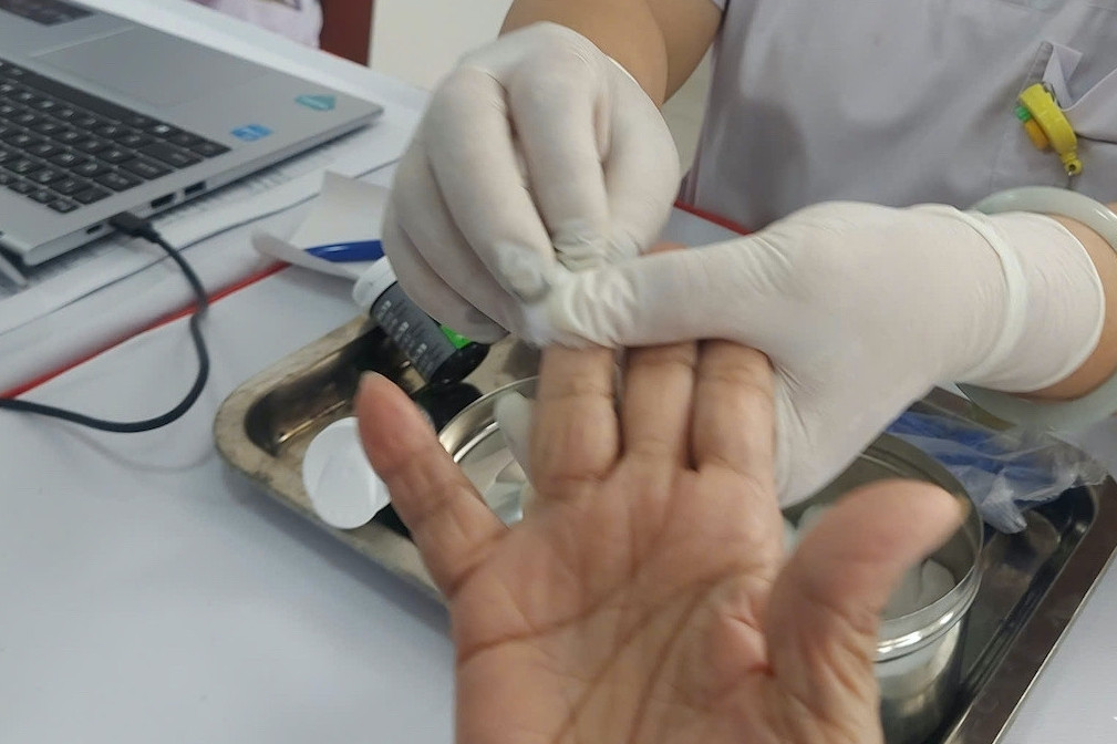 5 dấu hiệu cảnh báo mắc đái tháo đường thường bị bỏ qua