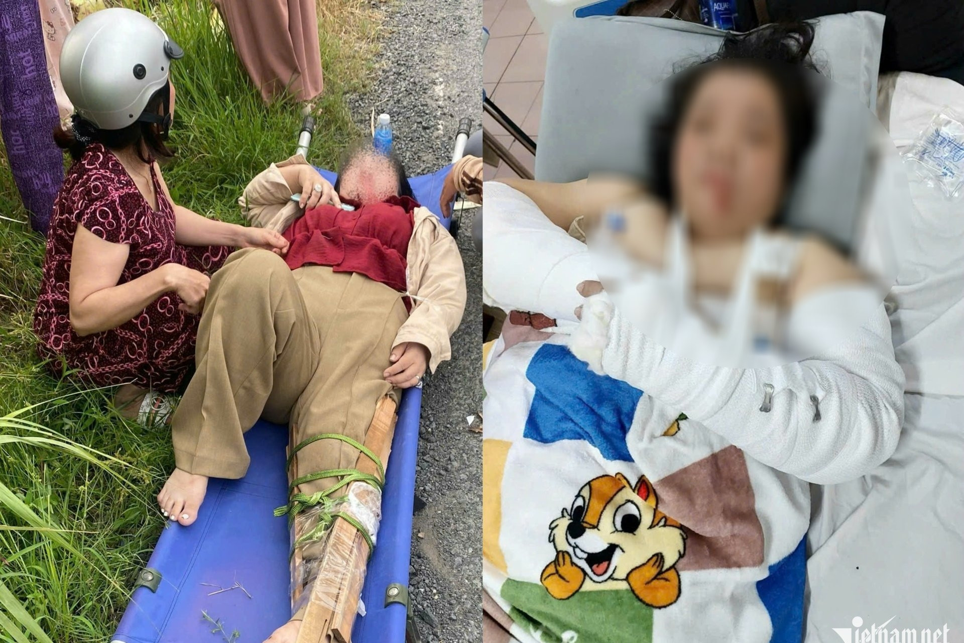 Liên tiếp 3 vụ tai nạn trên đoạn đường chi chít ổ gà, có cô giáo gãy cả tay và chân