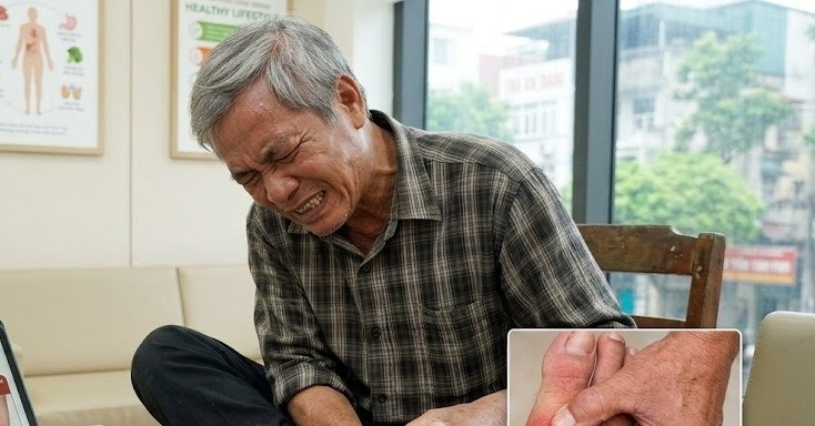 Kiêng khem đủ thứ, vì sao người mắc bệnh gout vẫn đau?