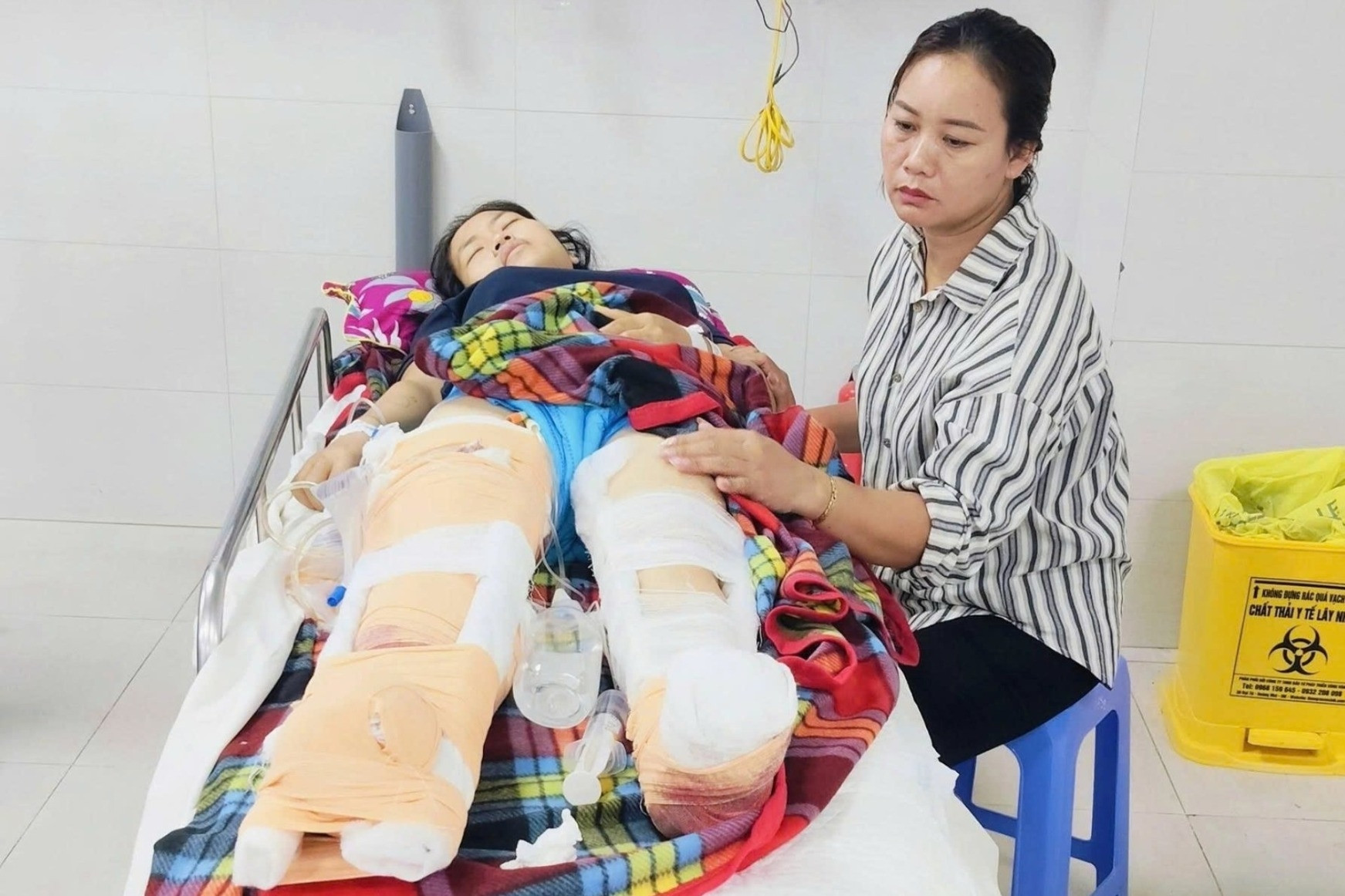 Cứu học sinh chạy ra đường, cô giáo mầm non bị xe tải cán phải cắt bỏ một chân