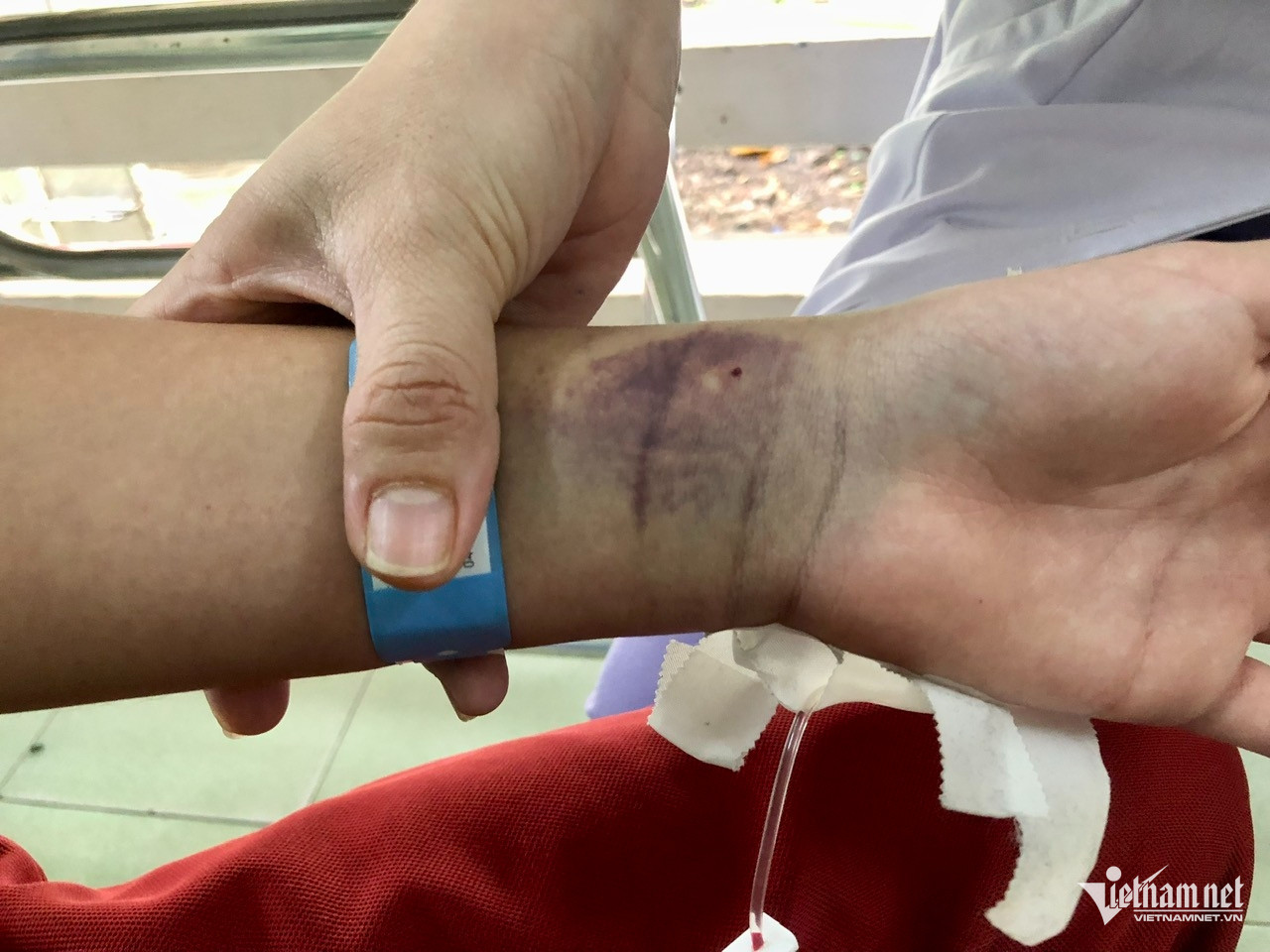 dengue Bachduong.jpg