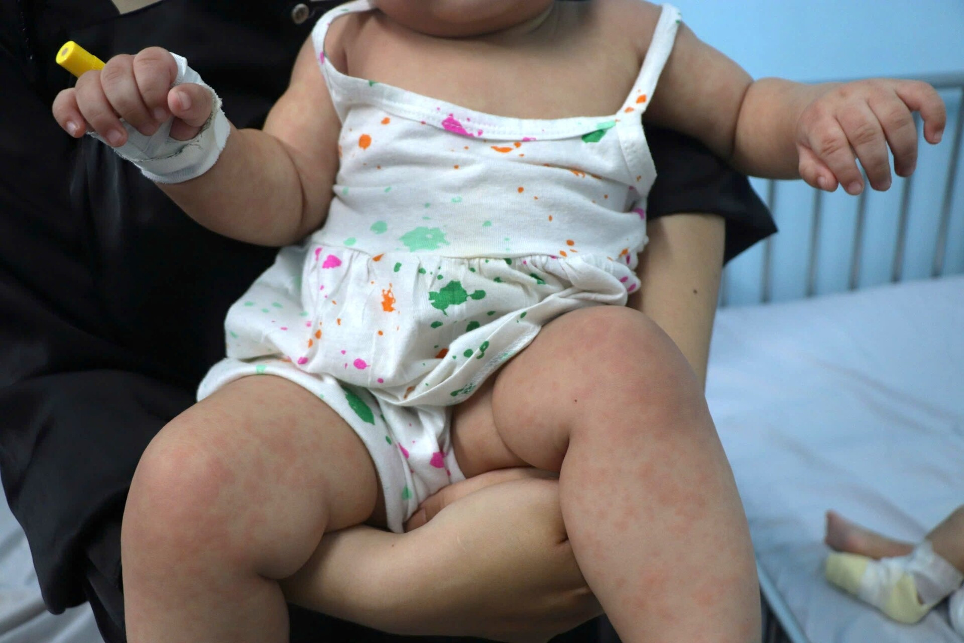 Anti-vaccine parents put children at risk