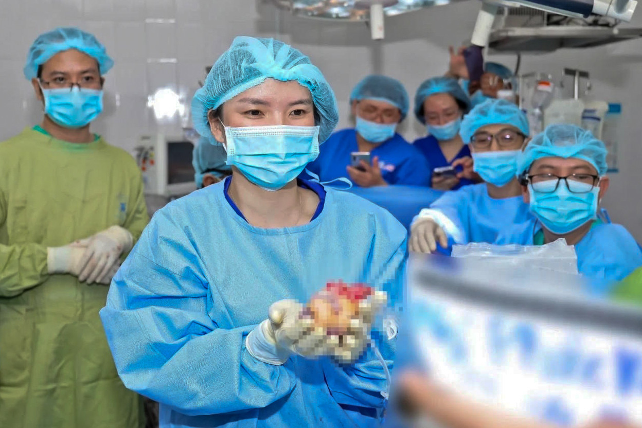 ghep tang 100487.jpg