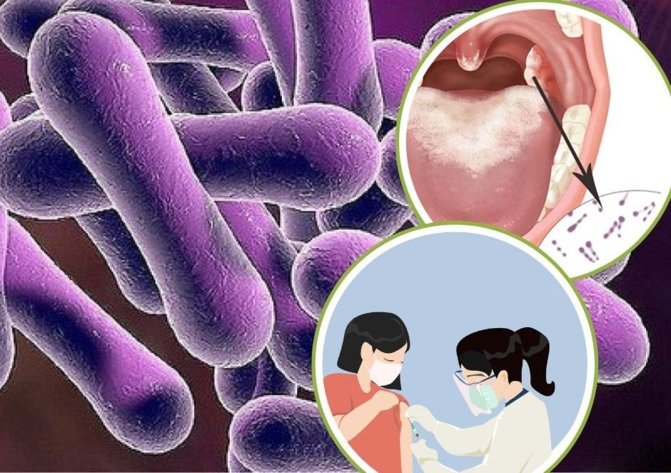 health ministry downplays diphtheria epidemic risk picture 1