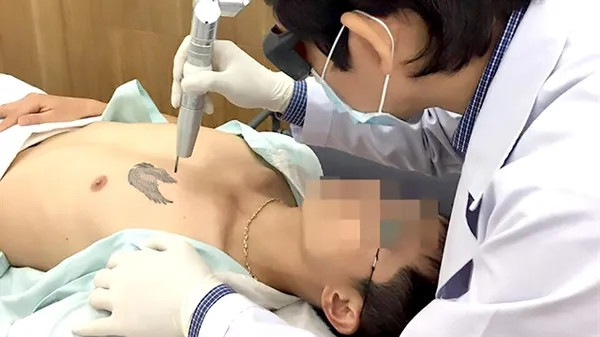 HCMC hospital receives more patients with tattoo-related complications
