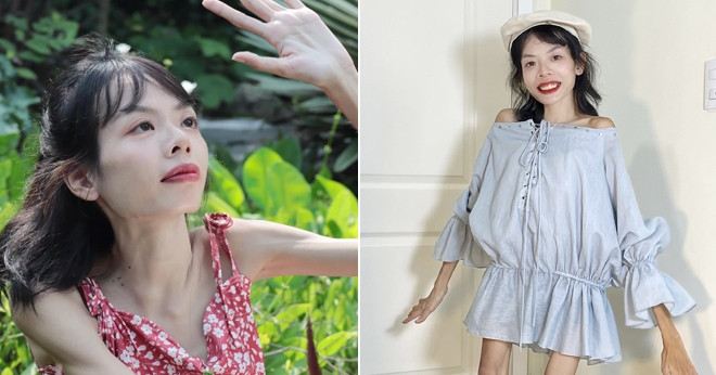 Despite weighing 27kg, Anh Thu inspires with her joyful spirit & artistic talent