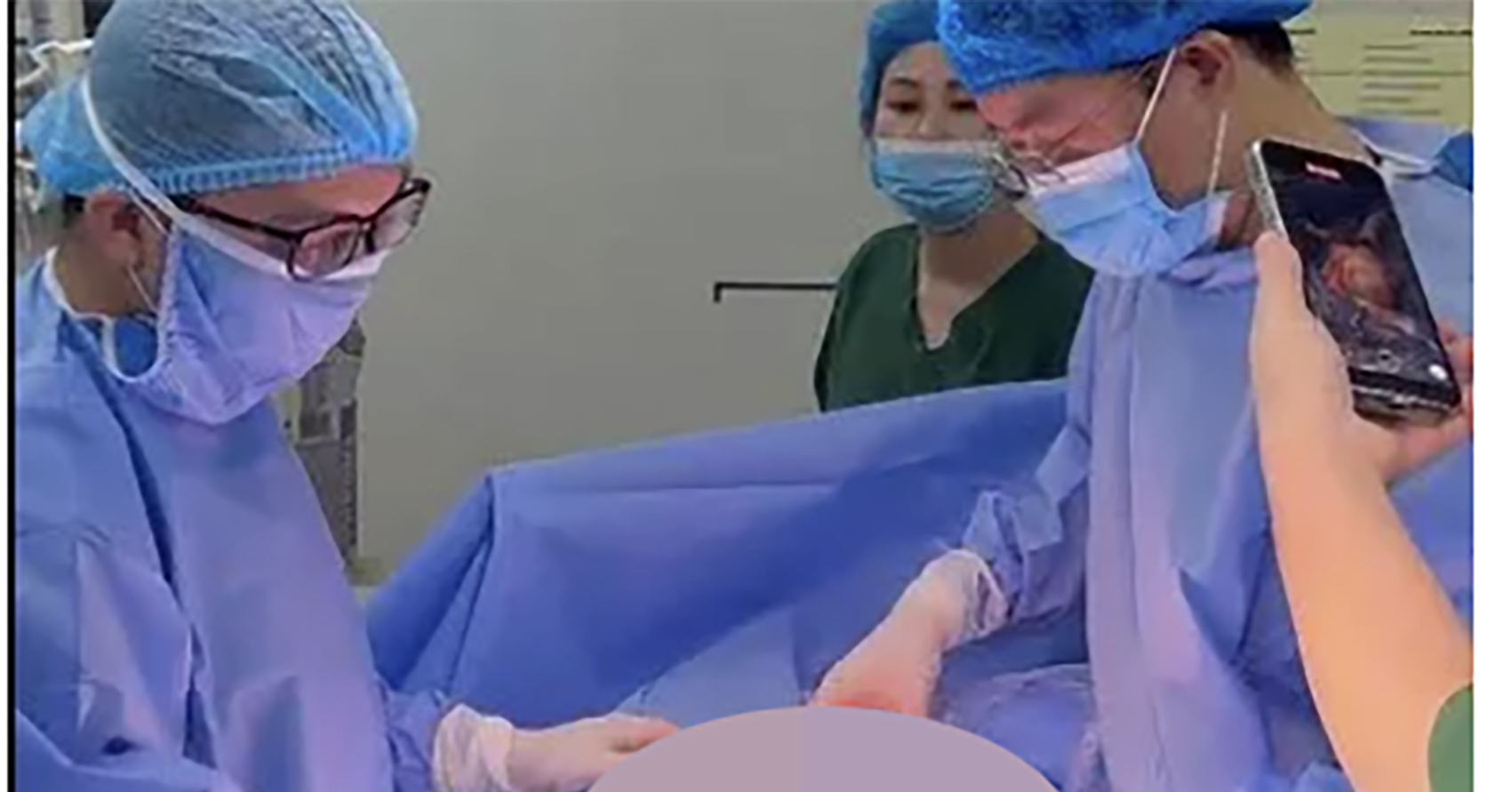Rare twin birth shocks doctors: both babies delivered in intact amniotic sacs