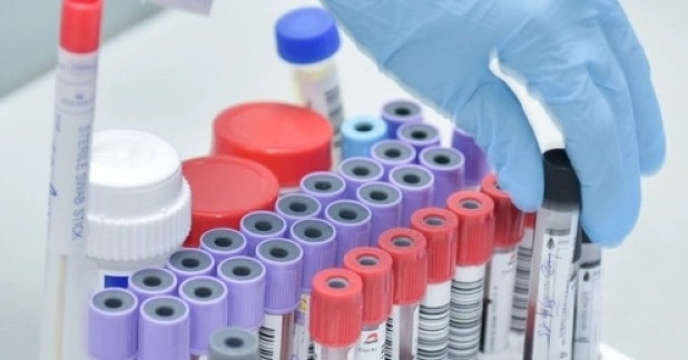 Vietnam’s medical sector eyes $24M annual savings through test result sharing