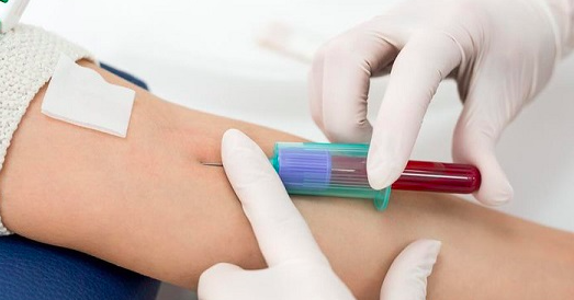 Experts warn against mass use of cancer marker tests