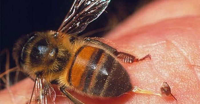 Bee sting ‘cure’ worsens cancer, leads to surgery for Vietnamese woman