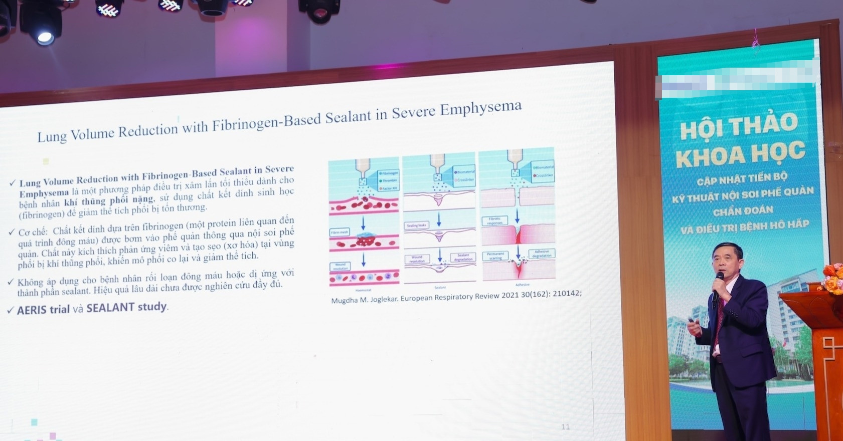 Respiratory diseases pose increasing challenges to healthcare in Vietnam