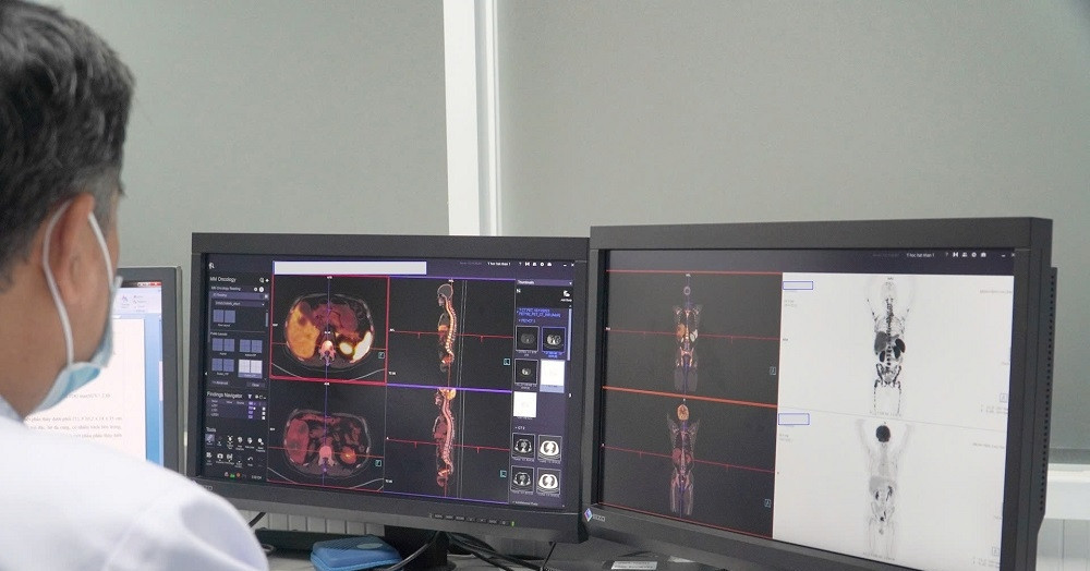 Southern Vietnam's only cyclotron offline, disrupting cancer scans