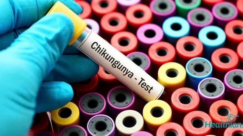 Vietnam boosts Chikungunya surveillance at borders and clinics