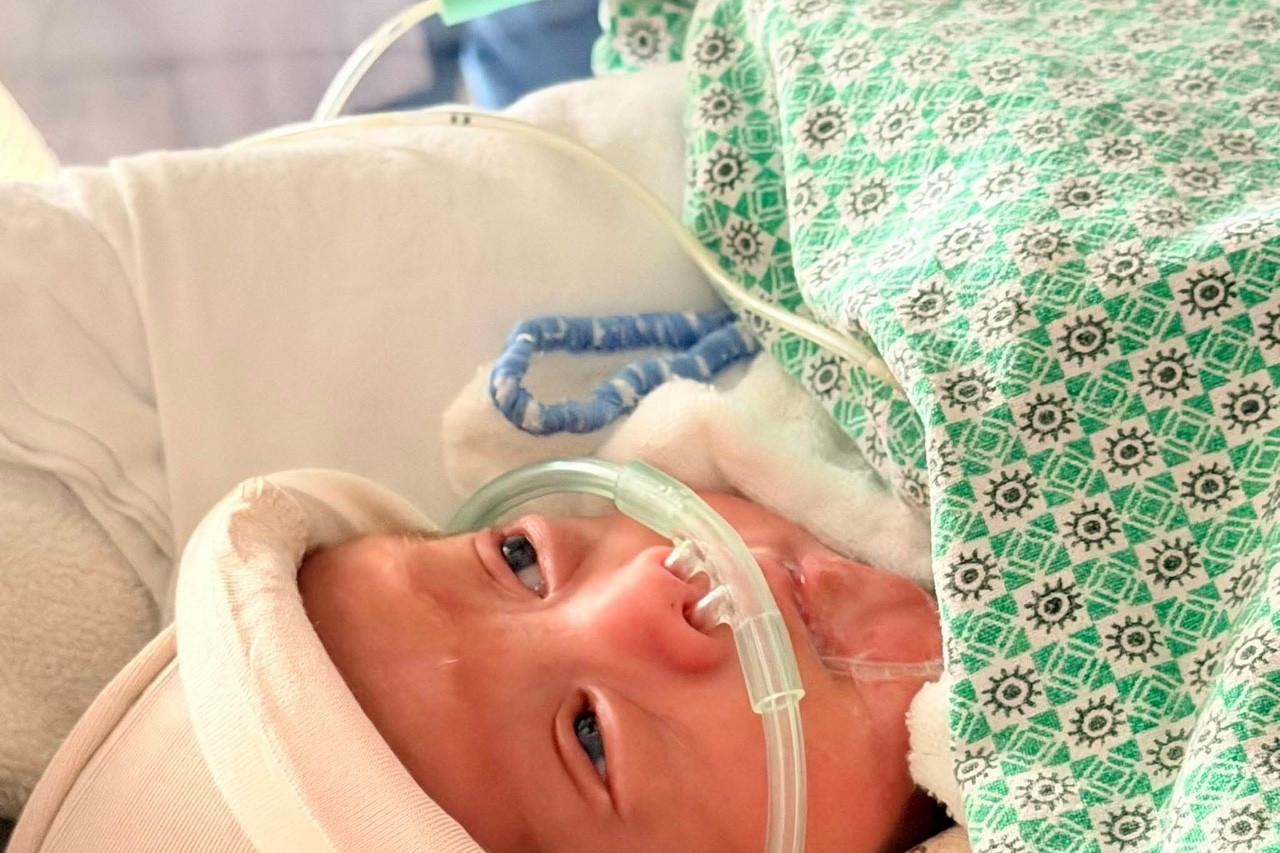 Tears in the operating room: welcoming a baby born at 24 weeks