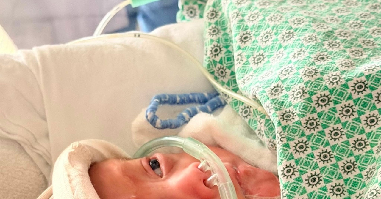 N.T.L. Survives High-Risk Pregnancy to Deliver Baby at 24 Weeks