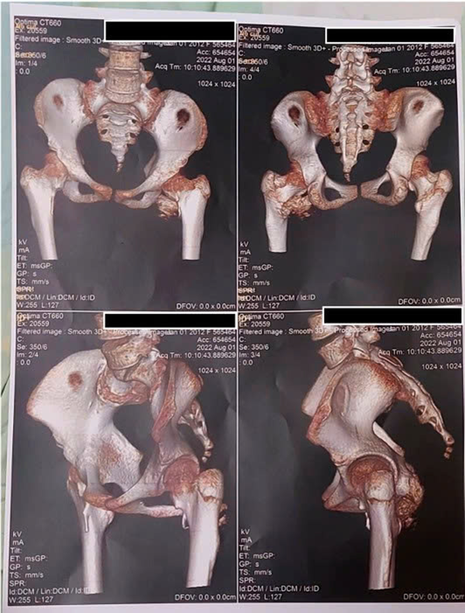 Bệnh nhi phát hiện mắc bệnh hiếm.png