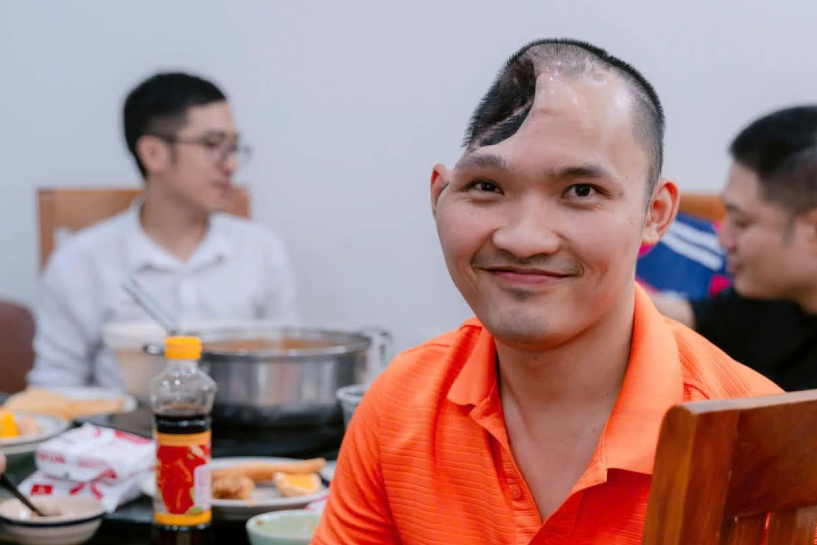 Half his skull gone, man fights for life through 20 surgeries over 11 years
